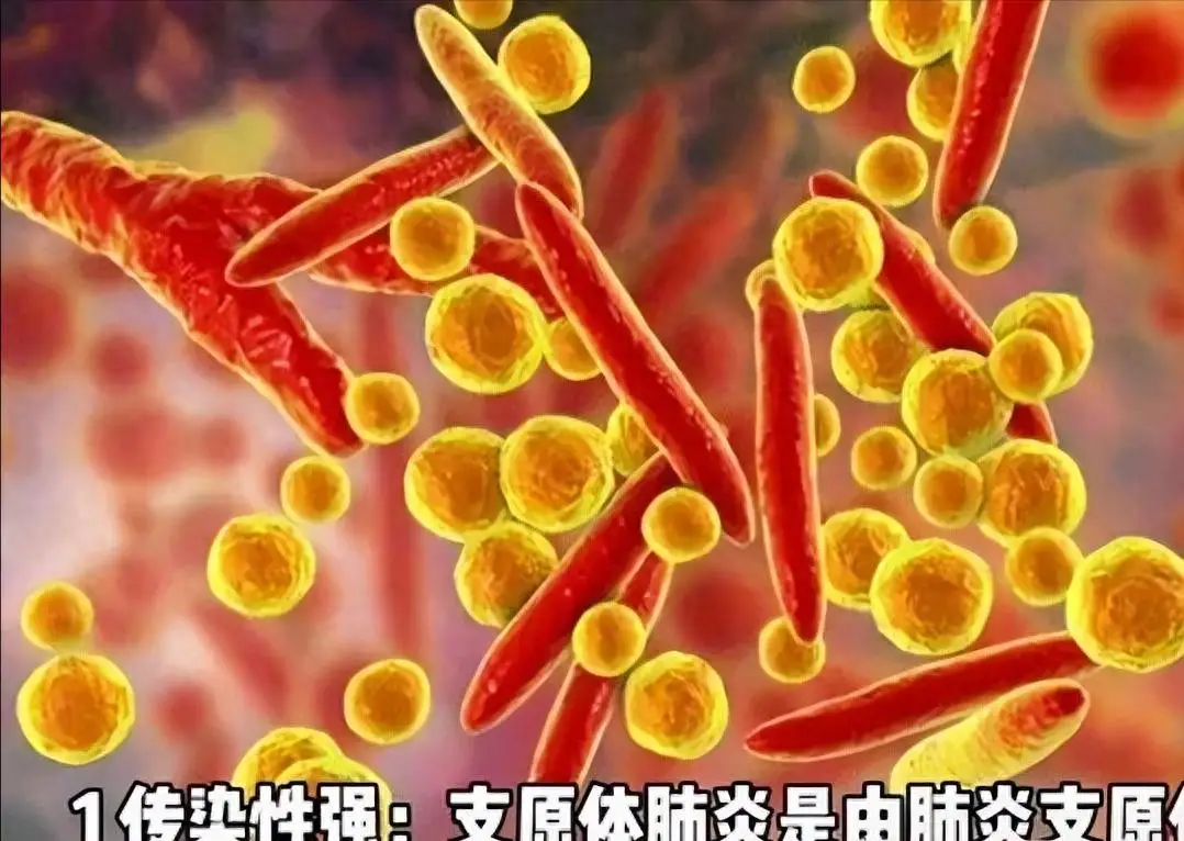 肺炎症状儿童_儿童肺炎症状_症状肺炎儿童吃什么药