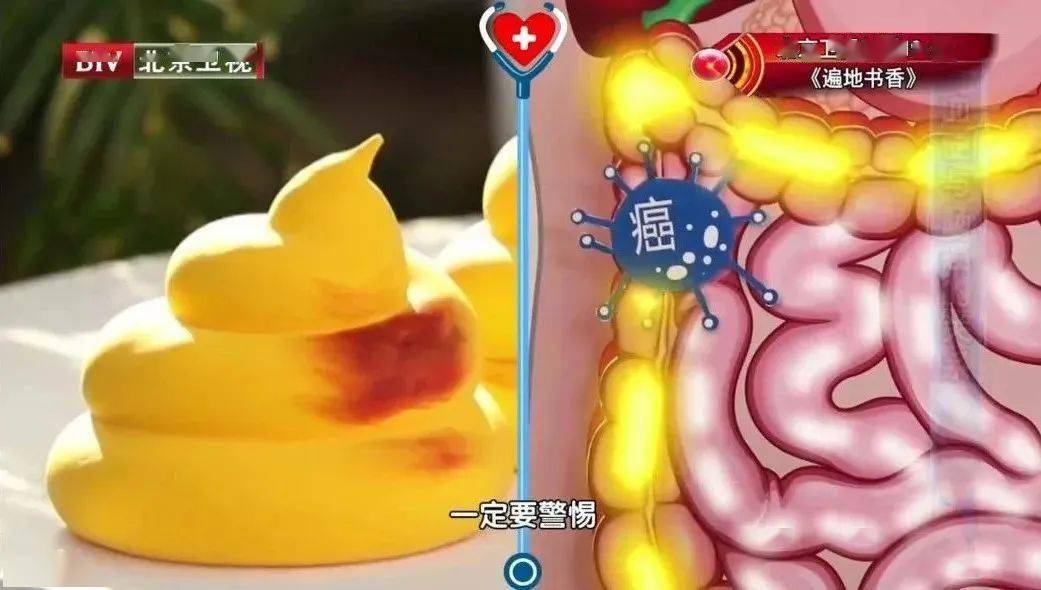 大便拉出鲜血的原因-大便拉出鲜血别害怕，可能是这些疾病在作祟