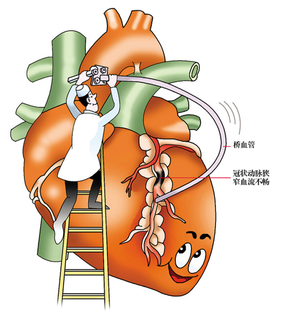 冠心病病例_冠心病诊断病历书写顺序_病例冠心病的鉴别诊断