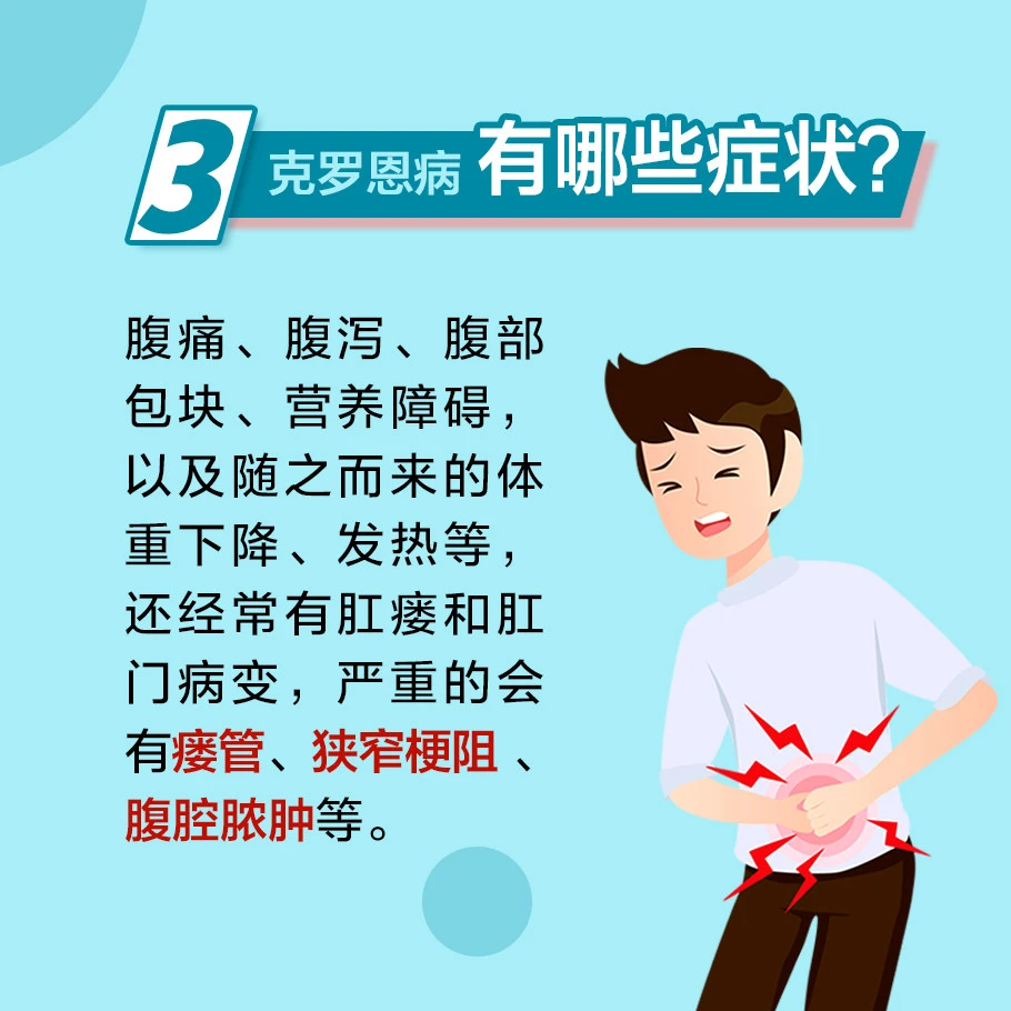罗克罗恩病的特征性体征_罗克罗恩病_克罗恩病好发部位